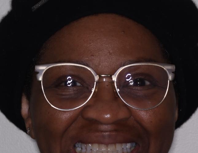 Ortho Full Face After